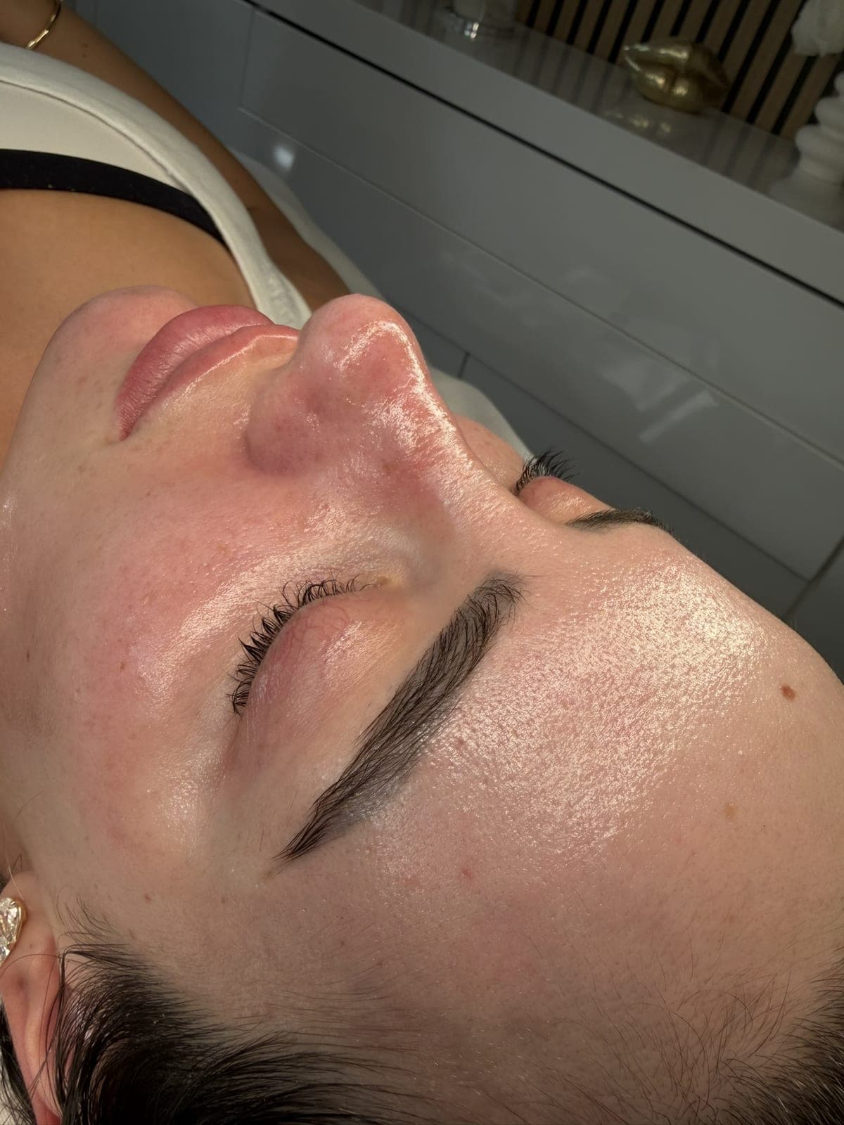 Client with fresh, glowing skin after a HydraFacial in Walthamstow